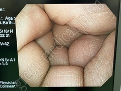 OLYMPUS High Definition Monitor