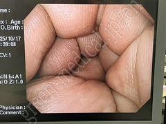 OLYMPUS High Definition Monitor