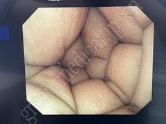 OLYMPUS High Definition Monitor