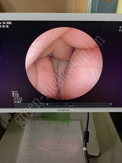 FUJIFILM Video Transnasal Gastroscope