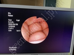 OLYMPUS Hysterofiberscope