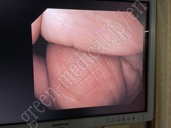 OLYMPUS Video Gastroscope