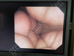 OLYMPUS Video Colonoscope