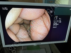 FUJIFILM Video Transnasal Gastroscope