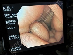 OLYMPUS Video Gastroscope