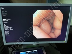 OLYMPUS Video Gastroscope