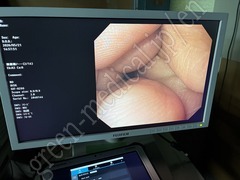 OLYMPUS Video Gastroscope
