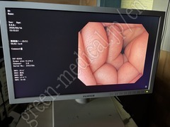 OLYMPUS Video Gastroscope