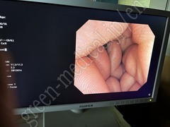 OLYMPUS Video Colonoscope