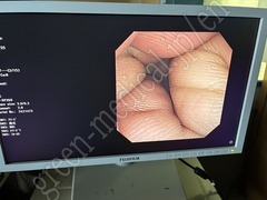 OLYMPUS Video Gastroscope