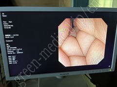 OLYMPUS Video Transnasal Gastroscope
