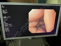 OLYMPUS Video Gastroscope