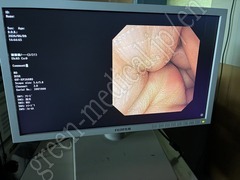 OLYMPUS Video Transnasal Gastroscope