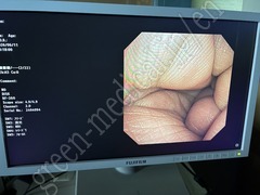 OLYMPUS Video Bronchoscope