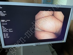 OLYMPUS Video Bronchoscope