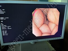 OLYMPUS Video Gastroscope