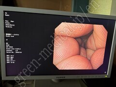OLYMPUS Video Gastroscope