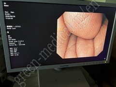 OLYMPUS Video Gastroscope