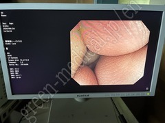 OLYMPUS Video Colonoscope
