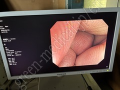 OLYMPUS Video Colonoscope