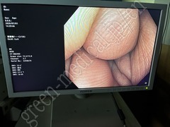 OLYMPUS Video Colonoscope