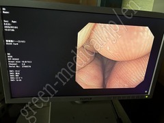 OLYMPUS Video Gastroscope