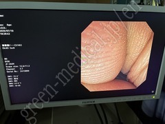 OLYMPUS Video Duodenoscope