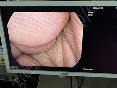 PENTAX Rhino Laryngoscope