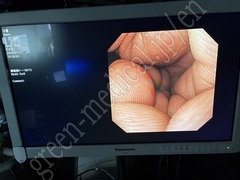 OLYMPUS Video Gastroscope