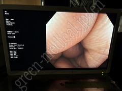 OLYMPUS Video Colonoscope