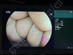FUJIFILM Video Colonoscope