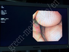 OLYMPUS Nasal Gastroscope
