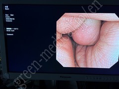 OLYMPUS Video Colonoscope