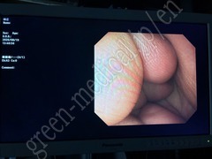 OLYMPUS Gastrointestinal Videoscope