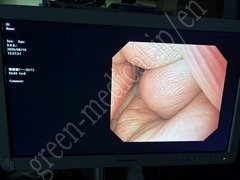 OLYMPUS Gastrointestinal Videoscope