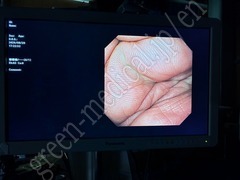 OLYMPUS Video Gastroscope