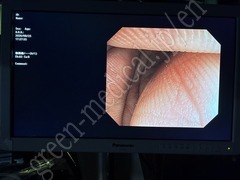 OLYMPUS Video Colonoscope