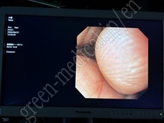 OLYMPUS Video Gastroscope