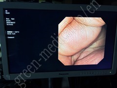 OLYMPUS Video Gastroscope