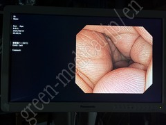 OLYMPUS Video Colonoscope