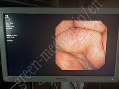 OLYMPUS Video Colonoscope