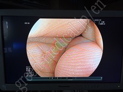 FUJIFILM Video Colonoscope
