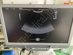 SIEMENS Color Doppler Ultrasound