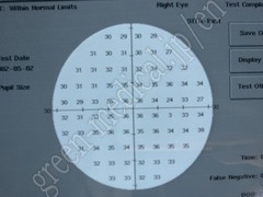 Carl Zeiss Humphrey Field Analyzer