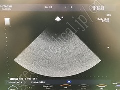 Hitachi Sector Probe Transducer