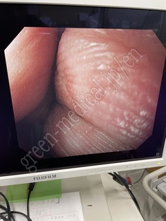 OLYMPUS Processor & Xenon Lightsource