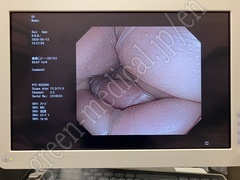 OLYMPUS Video Colonoscope