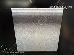 Hitachi Ultrasound Diagnostic System