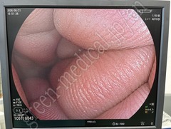 FUJIFILM Video Colonoscope