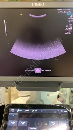 SIEMENS Color Doppler Ultrasound